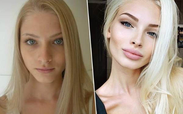 Alena Shishkova. Photos before and after plastic surgery. Biography, model operations, figure parameters