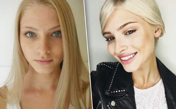 Alena Shishkova. Photos before and after plastic surgery. Biography, model operations, figure parameters