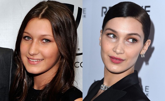 Bella Hadid prima e dopo la chirurgia plastica. Foto in costume da bagno, altezza e peso, parametri di forma, biografia, età