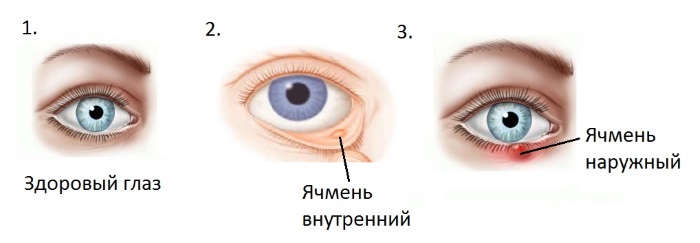 Blefarogel 2. Instructions for use, how to apply for barley, for face, eyelids, eyelash growth, for swelling under the eyes. Analogs