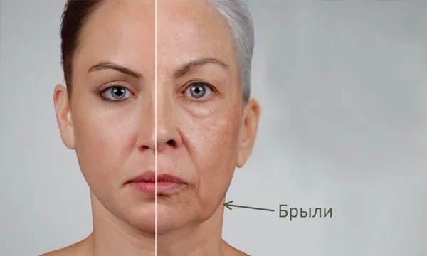 Flew on the face. How to get rid of, quickly remove, restore the oval of the face at home. Exercises, facial gymnastics, procedures