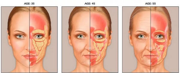 Flew on the face. How to get rid of, quickly remove, restore the oval of the face at home. Exercises, facial gymnastics, procedures