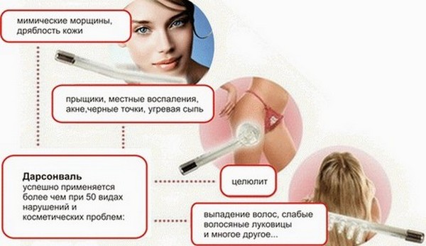 Darsonvalization - what is it in cosmetology, the benefits of the procedure for the skin of the face, head, eyelids, hair, devices. Indications and contraindications, effectiveness