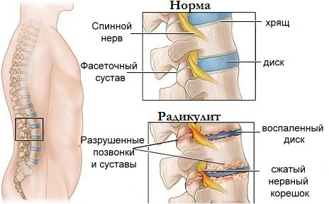 Darsonvalization - what is it in cosmetology, the benefits of the procedure for the skin of the face, head, eyelids, hair, devices. Indications and contraindications, effectiveness