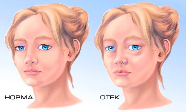 Gialripayer mesolift 02, 04, 06, 07, 08. Composizione di bioreparant, prezzo, recensioni di pazienti, cosmetologi