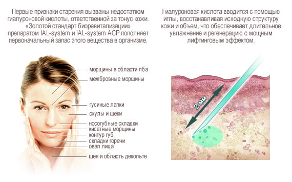 Gialripayer mesolift 02, 04, 06, 07, 08. Composizione di bioreparant, prezzo, recensioni di pazienti, cosmetologi