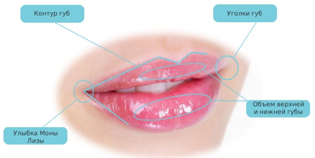 Lips before and after hyaluronic acid photo before and after augmentation. How long does the effect last when edema disappears