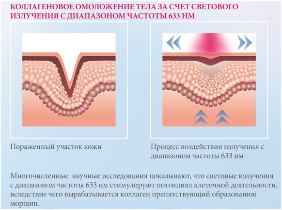 Collagenarium for face, body. What is this procedure, doctors' reviews, the benefits and harms of a solarium for the body. Before and after photos, side effects