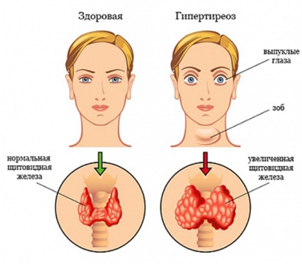 Collagenarium for face, body. What is this procedure, doctors' reviews, the benefits and harms of a solarium for the body. Before and after photos, side effects