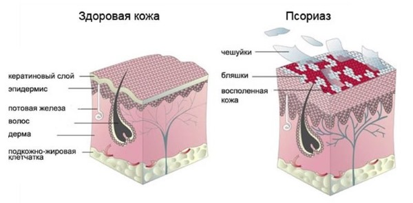 How to use Levomekol for acne on the face. Instructions, indications and contraindications