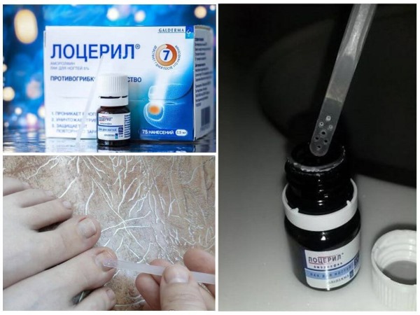 Loceryl varnish for nail fungus. Instructions on how to use, analogues, price, reviews