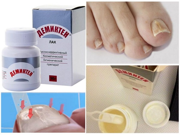 Loceryl varnish for nail fungus. Instructions on how to use, analogues, price, reviews