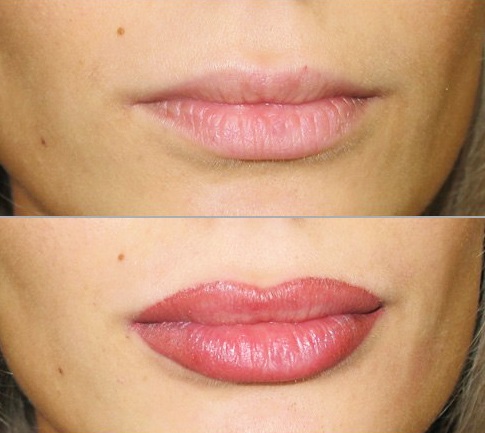 Permanent lip makeup: with shading, enlargement effect, 3d, ombre, in watercolor technique, velvet lips. Before and after photos