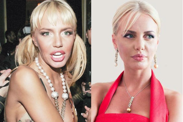 Masha Malinovskaya before and after plastic surgery. Photo, age, height and weight