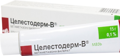 Ointments for acne on the face: inexpensive and effective with an antibiotic, for red, blackheads, acne, marks, for teens. Names and prices