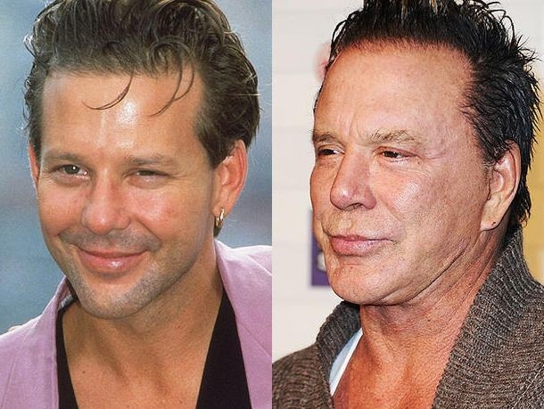 Top 10 unsuccessful plastic surgery stars. Photos before and after Soviet, Russian, foreign, Hollywood actors