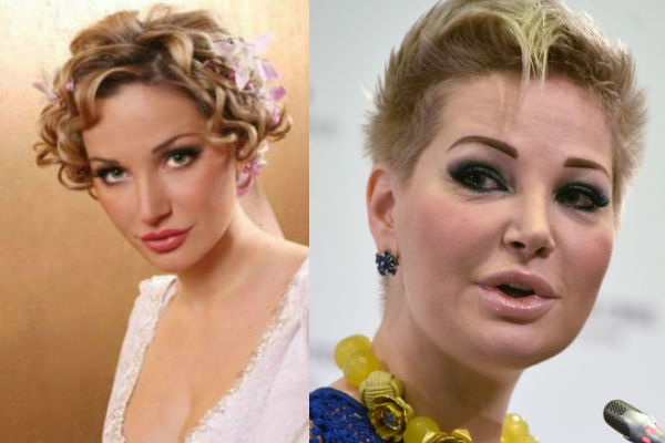 Top 10 unsuccessful plastic surgery stars. Photos before and after Soviet, Russian, foreign, Hollywood actors