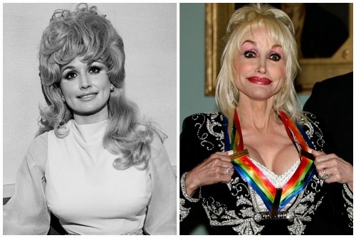 Le 10 migliori star della chirurgia plastica senza successo. Foto prima e dopo attori sovietici, russi, stranieri, hollywoodiani