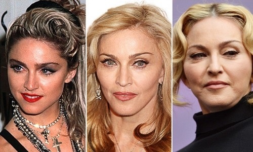 Top 10 unsuccessful plastic surgery stars. Photos before and after Soviet, Russian, foreign, Hollywood actors