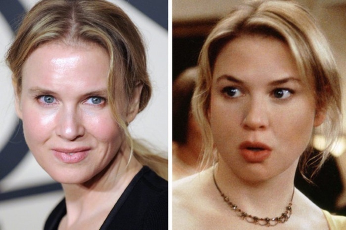 Top 10 unsuccessful plastic surgery stars. Photos before and after Soviet, Russian, foreign, Hollywood actors