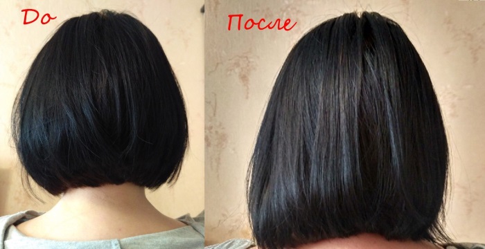 Nicotinic acid for hair. Application for hair loss and growth. Methods and instructions