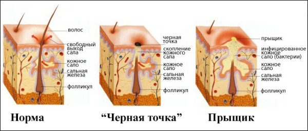 Cleaning your face at home. How to do from blackheads, acne, wen by folk remedies. Recipes for masks and scrubs, apparatus for home use