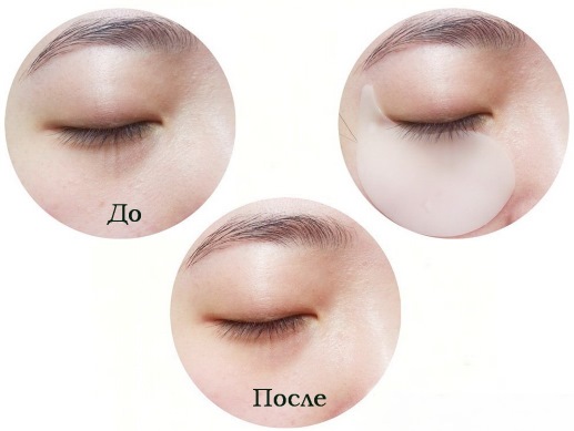 Eye patches - what is it, composition, how to use it. Rating of the best: Korean cosmetics, hydrogels, collagen, gold