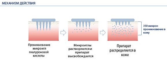 Eye patches - what is it, composition, how to use it. Rating of the best: Korean cosmetics, hydrogels, collagen, gold