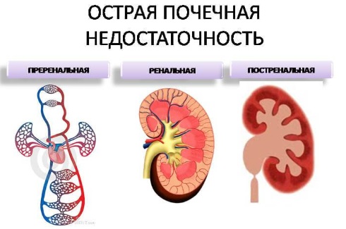 Plasmaphoresis - indications for use in gynecology, pregnancy, allergies, psoriasis. Possible side effects, cost of the procedure