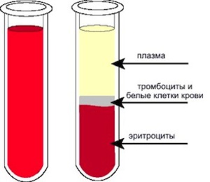 Plasmaphoresis - indications for use in gynecology, pregnancy, allergies, psoriasis. Possible side effects, cost of the procedure