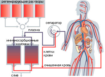 Plasmaphoresis - indications for use in gynecology, pregnancy, allergies, psoriasis. Possible side effects, cost of the procedure