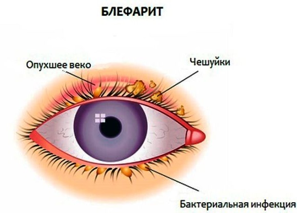 Means for the growth of eyelashes in pharmacies: oils, serums, biogel. How to strengthen eyelashes and improve their growth