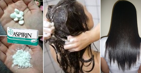 Home remedy for dandruff with aspirin, soda, vinegar, onions - folk. How to get rid of quickly and efficiently