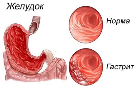 The daily rate of calories and BJU per day for a woman, man, teenager, pregnant woman. Rate for weight loss, muscle building