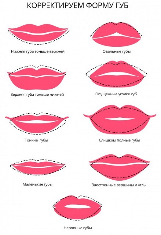 Lip augmentation with hyaluronic acid, fillers, botox, silicone, contour plastic. Photo, price, reviews