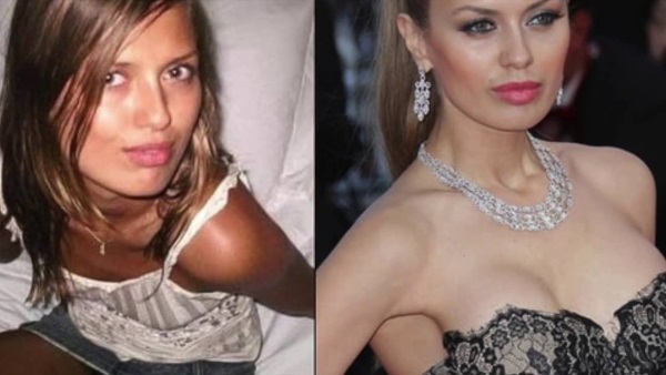 Victoria Bonya before and after plastic surgery - photo, personal life, height, weight. New plastic surgery