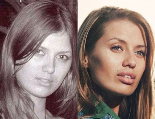 Victoria Bonya before and after plastic surgery - photo, personal life, height, weight. New plastic surgery