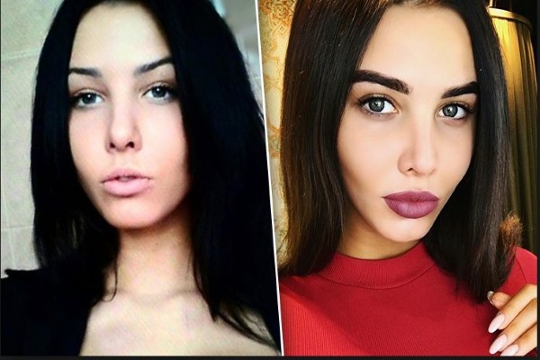 Anastasia Reshetova.Foto prima e dopo la chirurgia plastica, altezza, peso della ragazza, parametri corporei