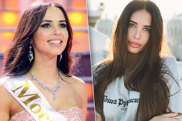 Anastasia Reshetova. Photos before and after plastic surgery, height, weight of the girl, body parameters