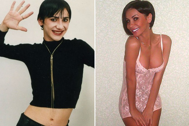 Erica Kisheva. Photos before and after sex reassignment surgery, plastic surgery of the face, body, chest, cheekbones, lips