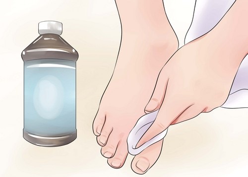 How to get rid of foot odor effectively. Best remedies in pharmacies, causes and treatments for sweating