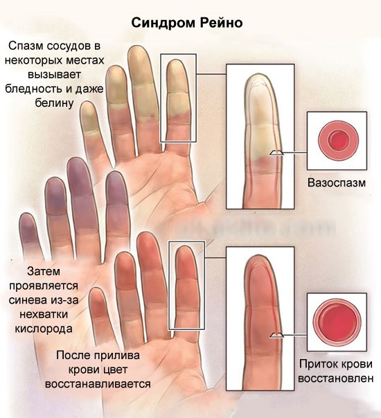 Carboxytherapy - what is it for a face in cosmetology: non-injection, non-invasive, injection. Before and after photos, price, reviews