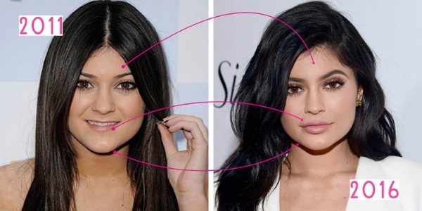 Kylie Jenner before and after plastic surgery: photos without makeup, photoshop, in a swimsuit, pregnant. How old, height, parameters, biography