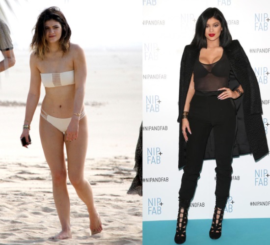 Kylie Jenner before and after plastic surgery: photos without makeup, photoshop, in a swimsuit, pregnant. How old, height, parameters, biography