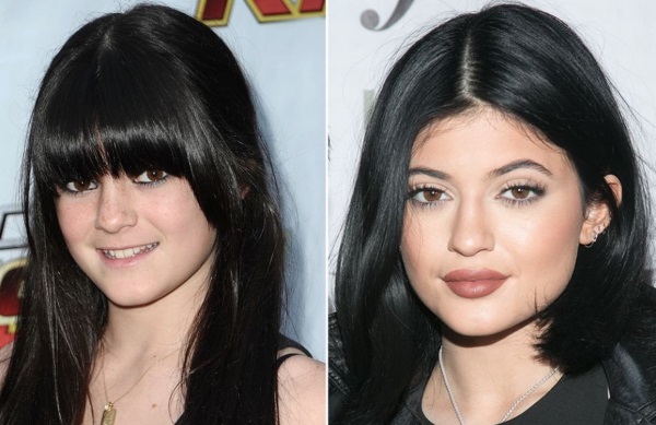 Kylie Jenner before and after plastic surgery: photos without makeup, photoshop, in a swimsuit, pregnant. How old, height, parameters, biography