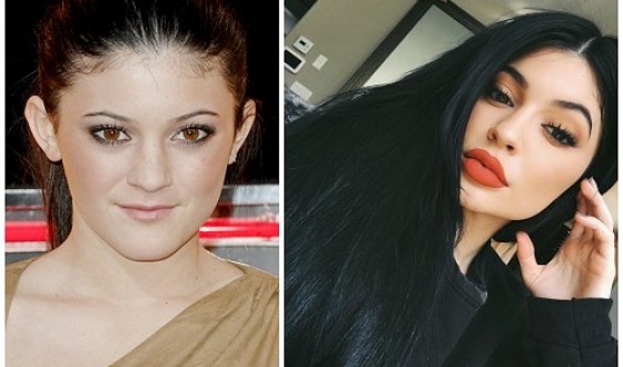 Kylie Jenner before and after plastic surgery: photos without makeup, photoshop, in a swimsuit, pregnant. How old, height, parameters, biography