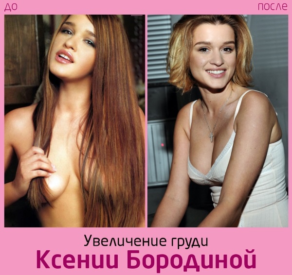 Ksenia Borodina. Photos before and after plastic surgery and weight loss. What operations did the star do, biography and personal life