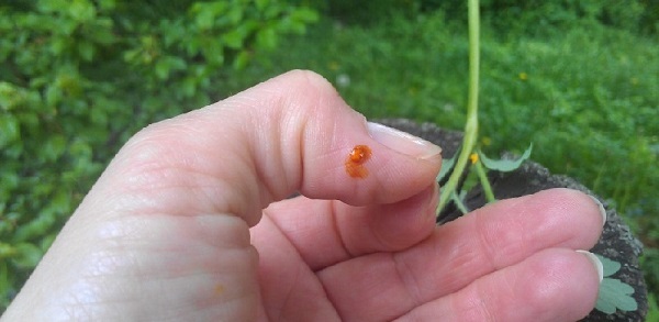 Olio di celidonia. Proprietà e applicazione per malattie della pelle e fungine, in cosmetologia, ginecologia