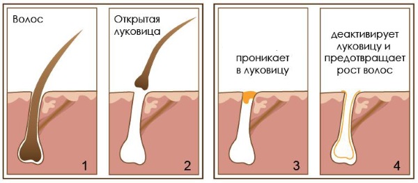 Olio di celidonia. Proprietà e applicazione per malattie della pelle e fungine, in cosmetologia, ginecologia