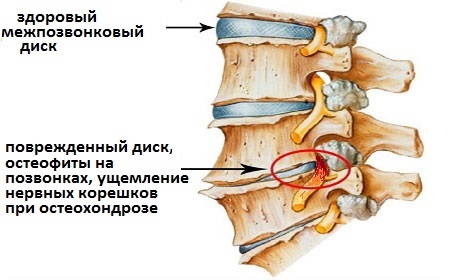 Back muscles: exercises to strengthen at home, in the gym, with osteochondrosis, scoliosis